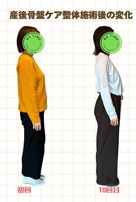 ビフォーアフター